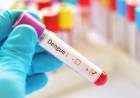 Aumentan casos de dengue: cuánto cuesta el test y cuándo conviene hacerlo
