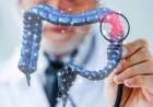 Cáncer de colon: cómo es el test simple e innovador con el que muchas personas podrían evitar la colonoscopia